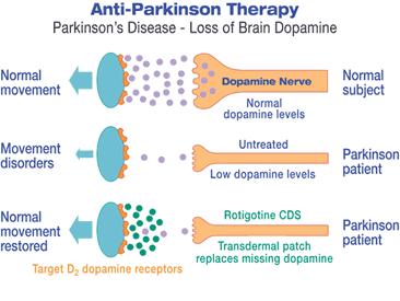 Anti-Parkinsons Therapy Loss of Brain Dopamine